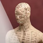 The Healing Landscape of Scalp Acupuncture